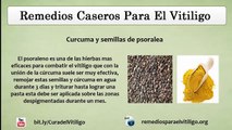 Remedios Caseros para el Vitiligo