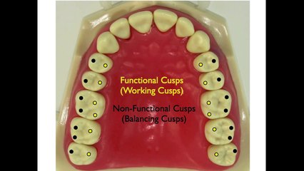Occlusion for the Dental Staff