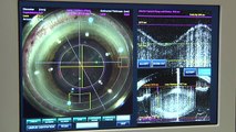 Eye News TV-Watch live surgery using the laser cataract system - how does it work?