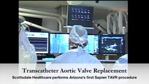 TAVR heart procedure for inoperable aortic stenosis