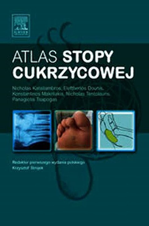Download Atlas stopy cukrzycowej Ebook {EPUB} {PDF} FB2