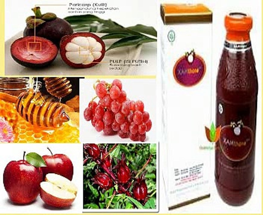 Cara Menghilangkan Sakit Saat Nyeri haid