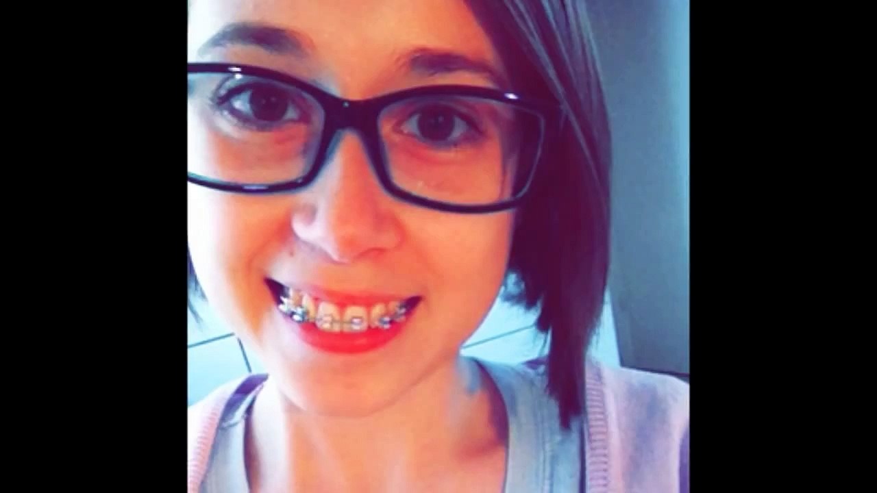 Fake Zahnspange ganz einfach selber machen - Little Manuli ♥