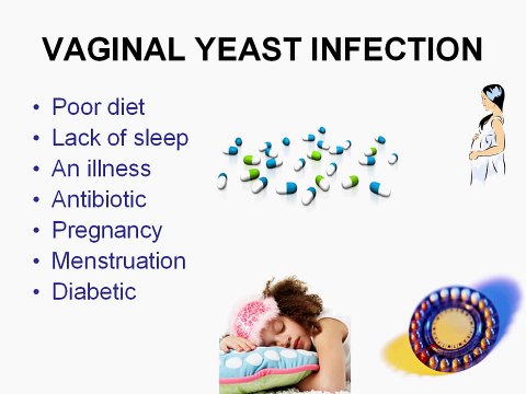 Fishy Vaginal Odor / Bad Vagina Smell / Vaginal Yeast Infection