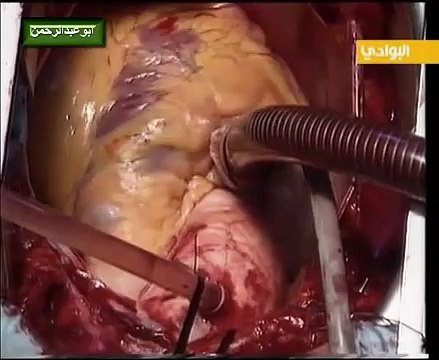 كيف يعمل ويضخ قلبك سبحان الله( وَفِي أَنْفُسِكُمْ أَفَلا تُبْصِرُونَ