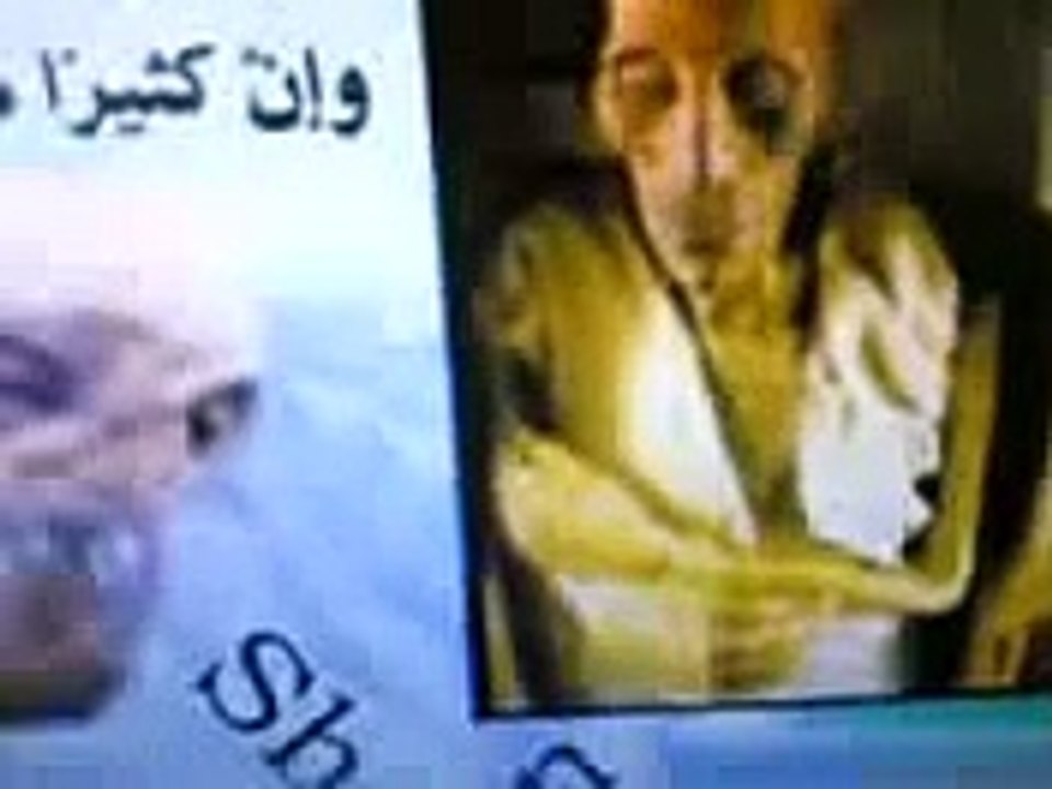 İslam Düşmanı ariel şaronun Komadaki Hali