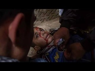 قصة صورة| الطفل «مينا» ضحية مظاهرات «الإخوان» في ذكرى الثورة