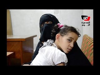 روميساء طفلة تقرأ حركة الشفاه وتحتاج لـ«قوقعة» لتسمع