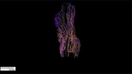 Next Big Thing No. 4: Disruptive Luxury