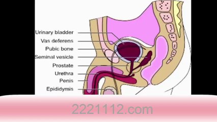 Urinary Tract Infections