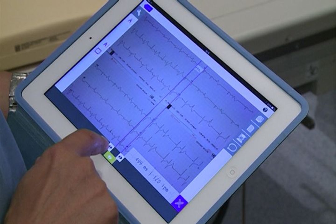 Compartir electrocardiogramas a través de una 'App'