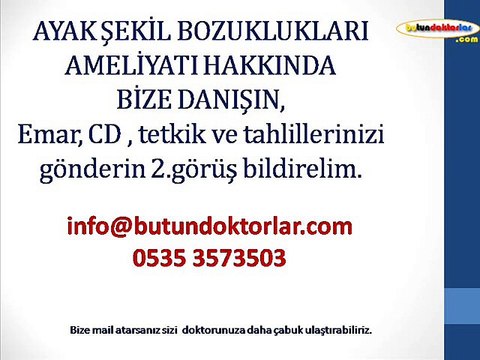 ayak bileği ağrısı 0535 3573503,ayak bileği şişmesi,ayak bileği egzersizleri,ayak bileği burkulması,ayak bileği anatomisi,ayak bileği yan bağları,ayak bileğinde ödem,Ayak Bileği Ağrısı,Ayak Bileği Şişmesi,Ayak Bileği Egzersizleri,Ayak Bileği Burkulması