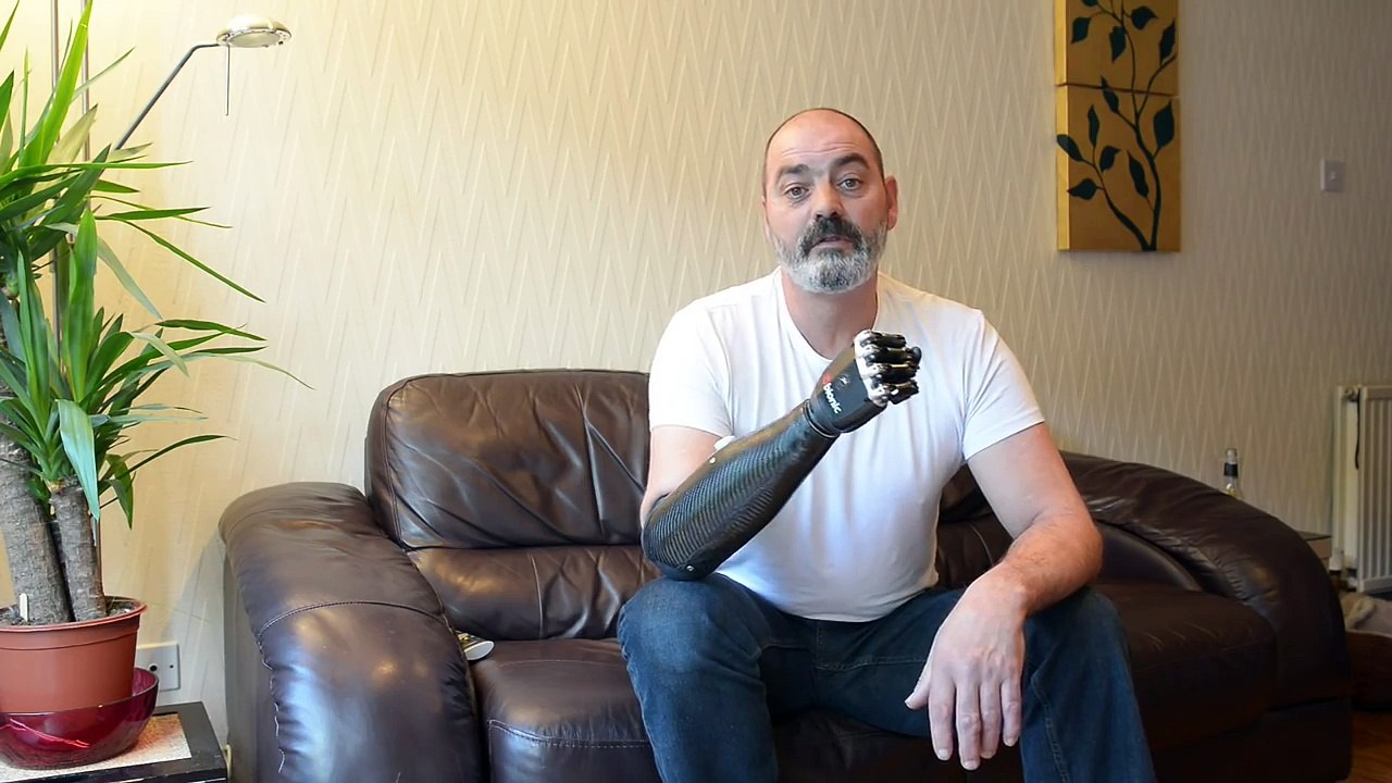 Nigel Ackland et son bras Bebionic v2