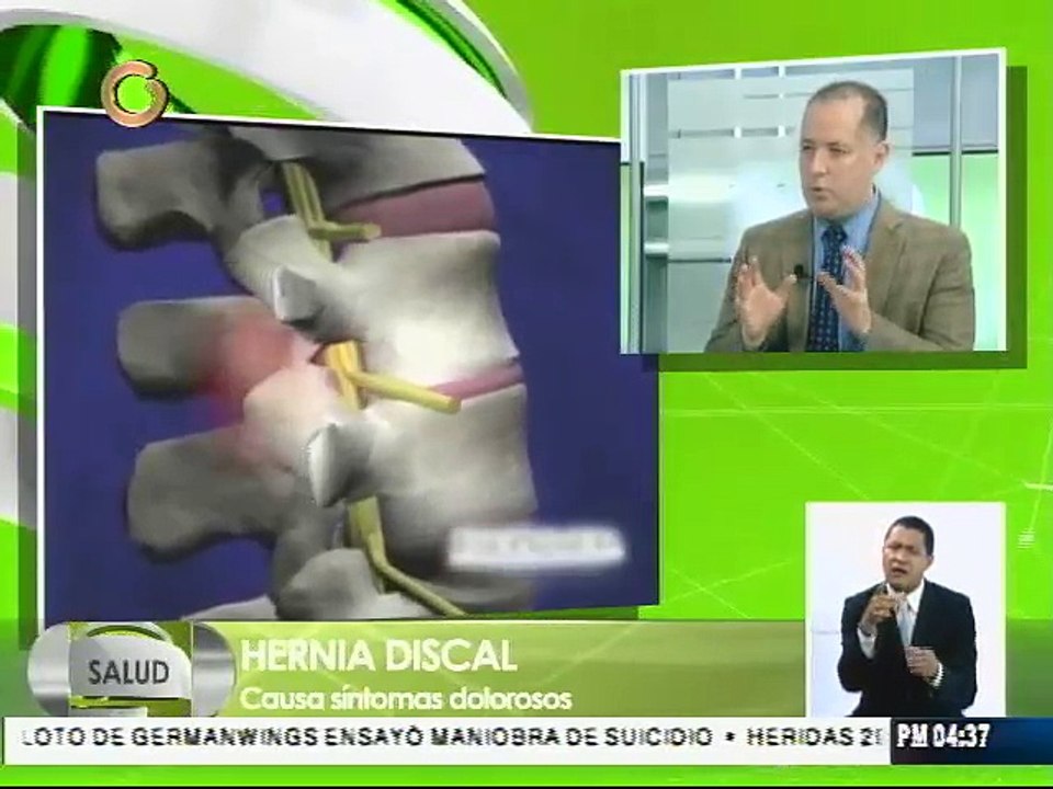 Personas con hernias discales deben utilizar faja abdominal