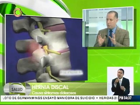 Personas con hernias discales deben utilizar faja abdominal