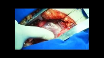 EDUDOC 01-2015: Avances de ciencia en medicina