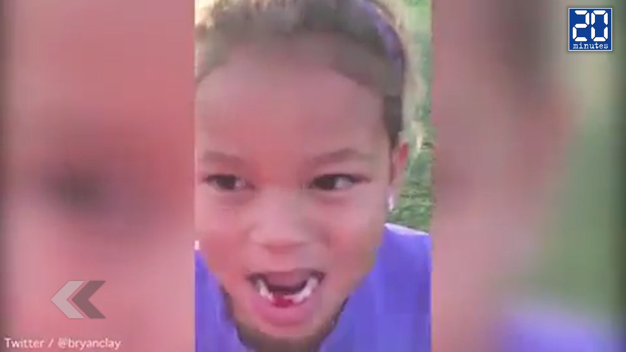 Il arrache la dent de sa fille avec un javelot Le Rewind du Jeudi 07 mai 2015