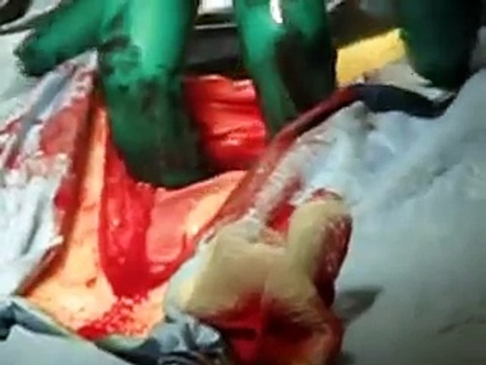 Labrador Retriever C-Section