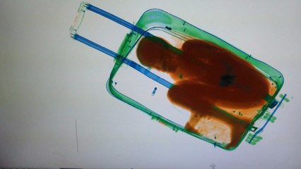 That's A Boy In That Suitcase