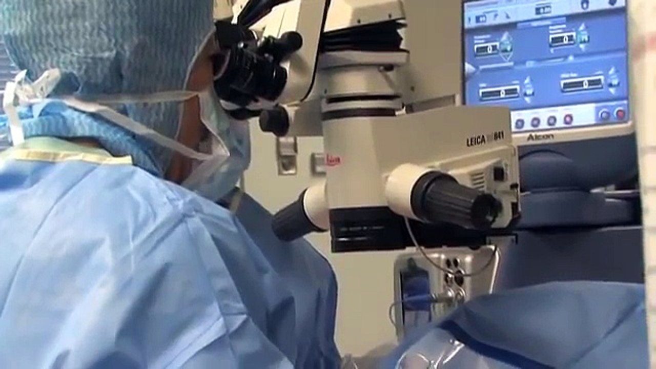 Oeil : Une opération de la cataracte en vidéo