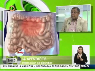 La apendicitis es más frecuente en hombres