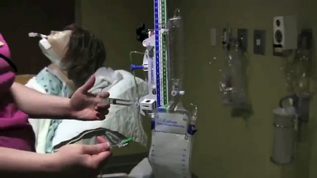 External Ventricular Drain Placement by Dr. Michael Horowitz M.D.