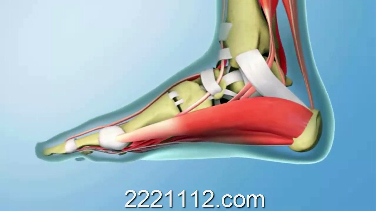 Heel Pain & Treat it