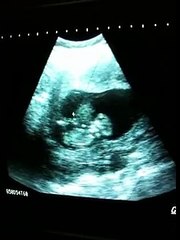 baby playing in mother's womb !!!!!