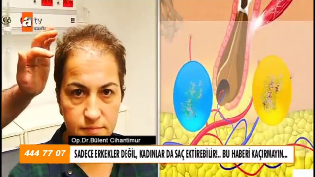 Zahide ile yetiş hayata Organik Saç Ekimi