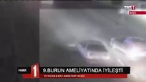 9'uncu Burun Ameliyatından Sonra Nefes Almaya Başladı