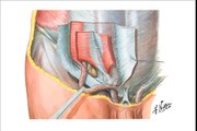 Abdominal-Wall-Hernias