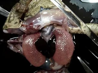 Nerve Physiology - heart