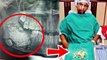 Indian boy Ashik Gavai has 232 teeth removed in JJ Hospital, Mumbai