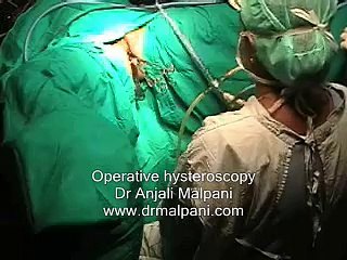 Operative hysteroscopy