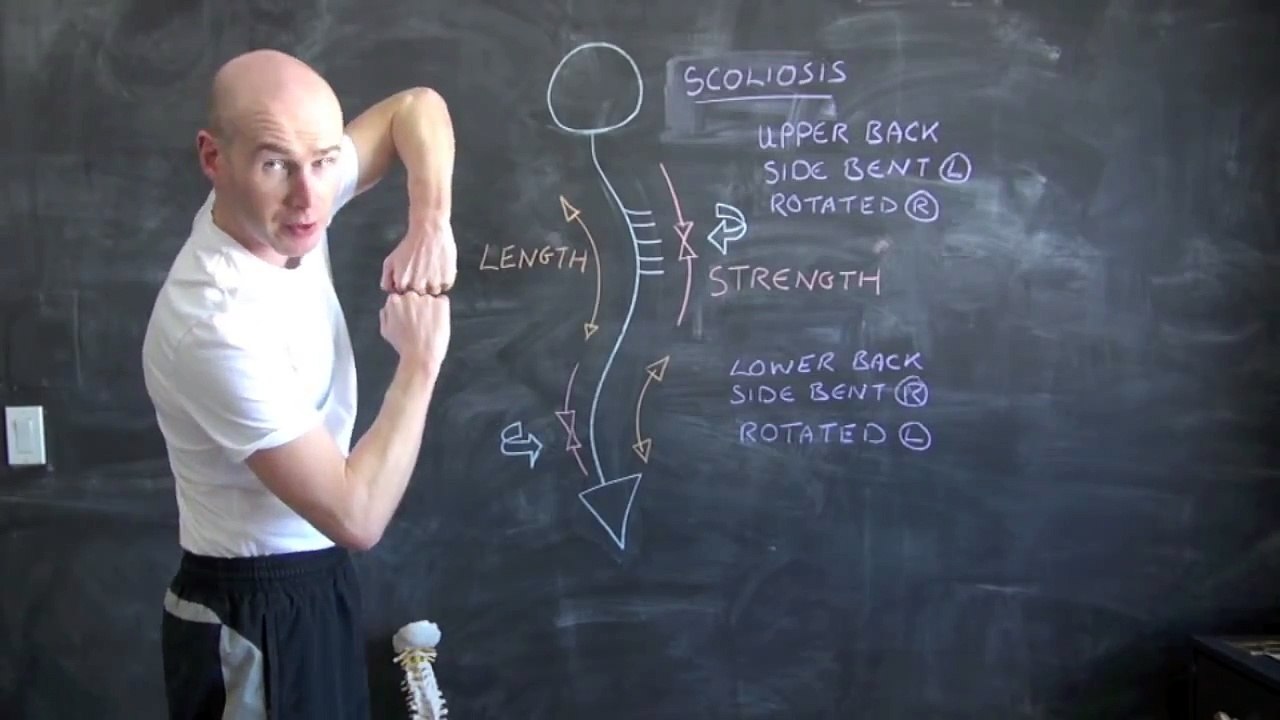 How to Correct a Scoliosis With Exercise and Stretching - Ed Paget