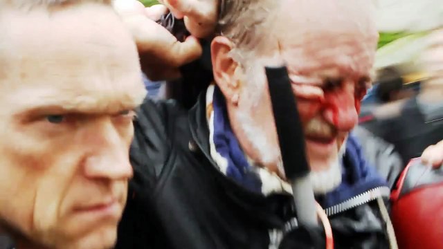 Stuttgart 21 - Horror im Schlossgarten - Parkschützer Vol.1 - Opfer staatlicher Gewalt S21