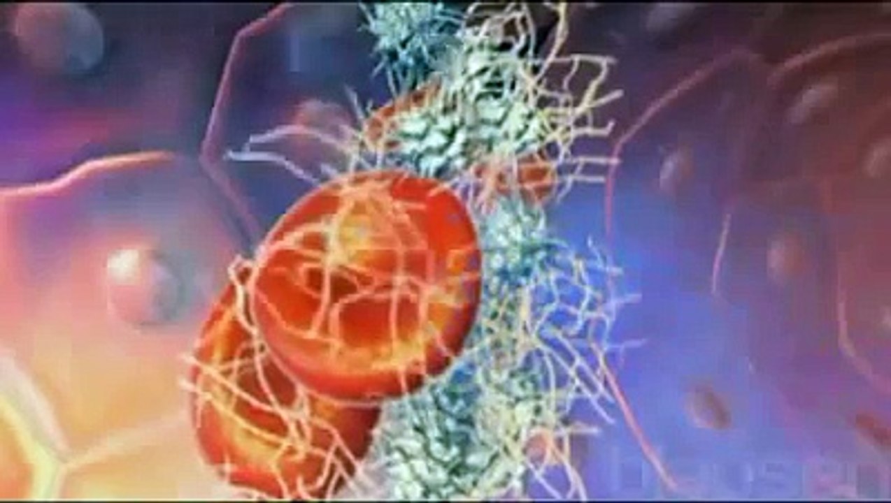 Thrombocytopenia
