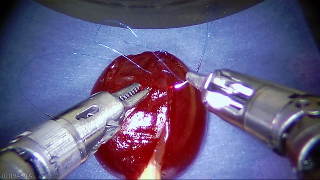 Medical Robot Stitches a Grape Back Together : amazing Da Vinci robot!