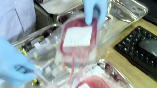 Cryobanks Cord Blood Stem Cell Banking in India