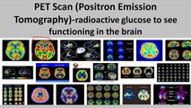 Brain Scans--A Comparison