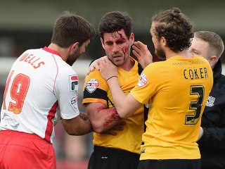 Le violent choc tête contre tête entre Michael Timlin et Bira Dembele
