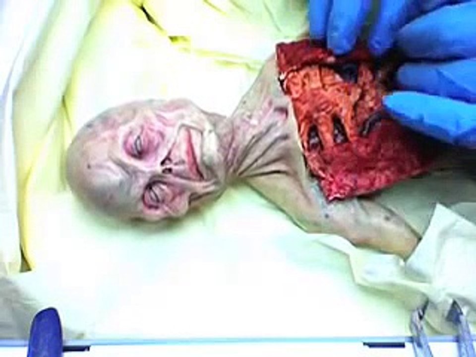 Alien Autopsy
