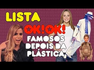 Top 6 famosos mais irreconhecíveis depois da plástica EVEEEEEEEEEEER