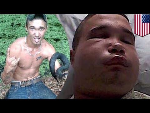 Hombre se salva de milagro luego de intentar darle un beso a serpiente venenosa