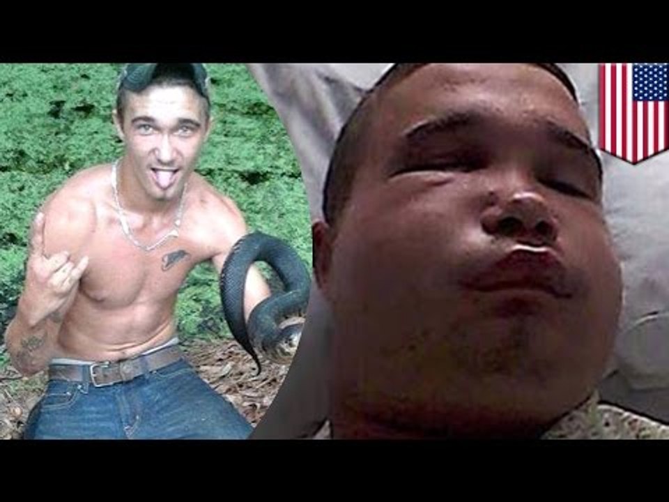 Hombre se salva de milagro luego de intentar darle un beso a serpiente venenosa