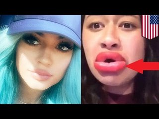 Estúpidos adolescentes en todo el mundo están haciendo el #KylieJennerChallenge