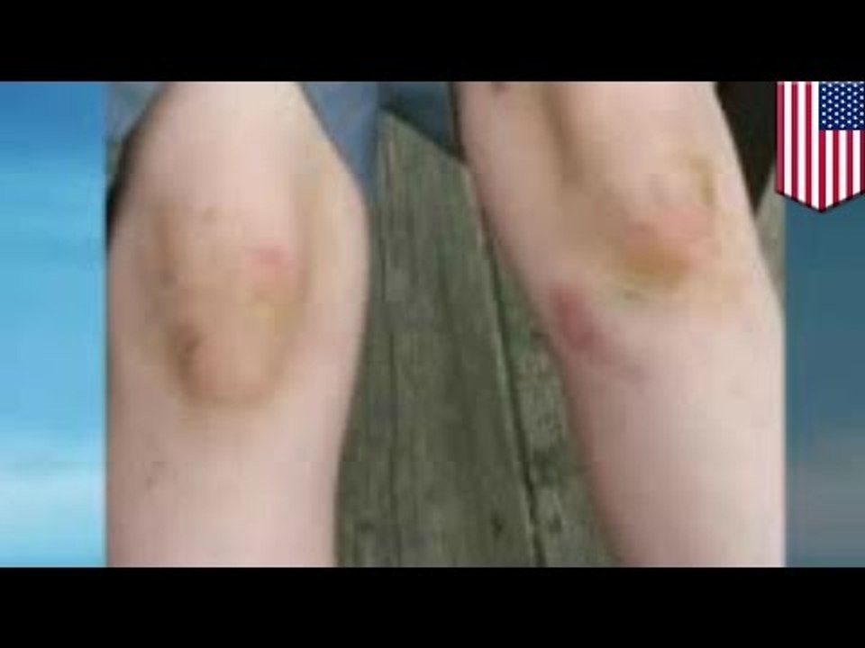 Elementary school bullying drives second grader to suicide attempt, mom sues school district