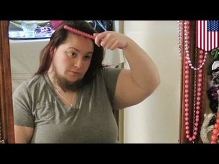 Bearded lady considers shaving for the first time in years for wedding anniversary photos