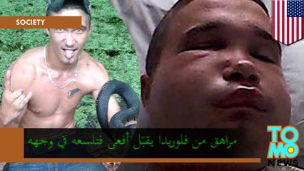 أفعى قاتلة تلسع رجلاً كان يحاول أن يقبّلها تاركةً وجهه متورماً