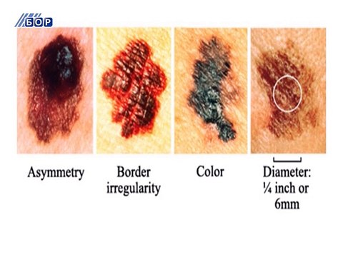 Vesti na rumunskom jeziku, 11. maj 2015. (RTV Bor)